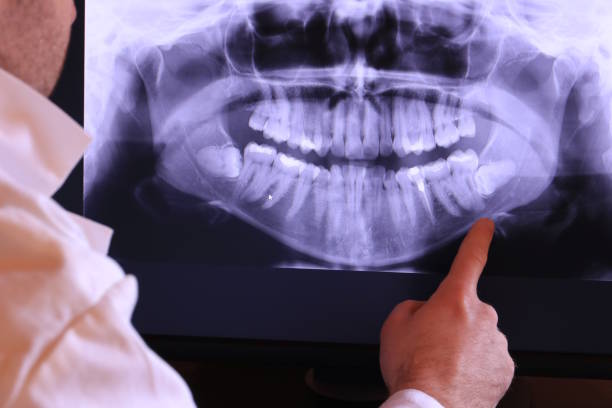 Best Emergency Root Canal Therapy in West Falmouth, MA